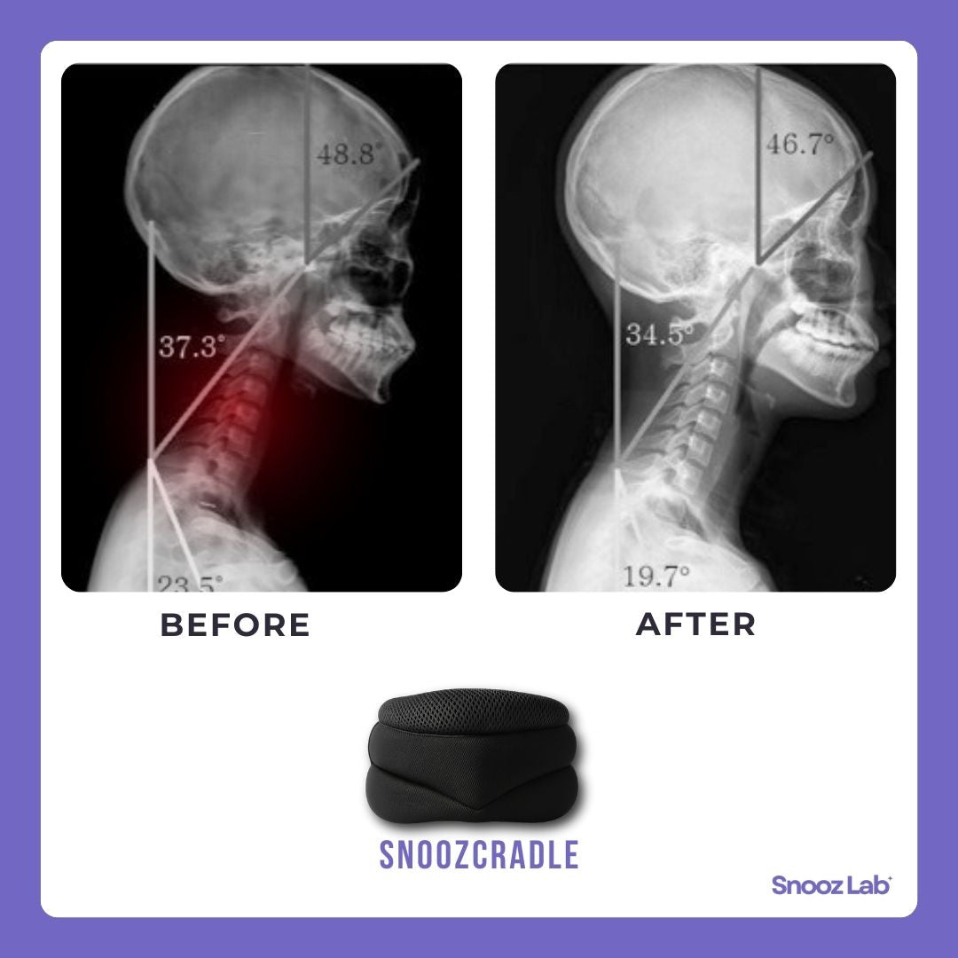 SnoozCradle ™